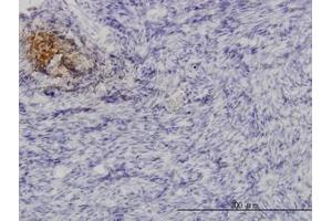 Image no. 1 for anti-Angiopoietin-Like 1 (ANGPTL1) (AA 24-492) antibody (ABIN598593) (ANGPTL1 抗体  (AA 24-492))