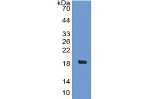 WB of Protein Standard: different control antibodies against Highly purified E. (BNP ELISA 试剂盒)