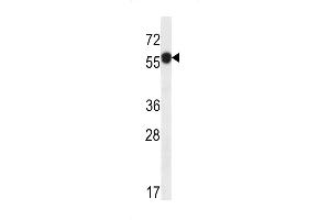 Western blot analysis in ZR-75-1 cell line lysates (35ug/lane). (C6ORF211 抗体  (N-Term))