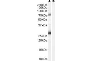 Image no. 1 for anti-Estrogen Receptor Binding Site Associated, Antigen, 9 (EBAG9) (C-Term) antibody (ABIN374701) (RCAS1 抗体  (C-Term))