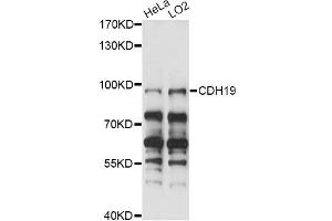 Western blot analysis of extracts of various cell lines, using CDH19 antibody (ABIN6291652) at 1:1000 dilution. (CDH19 抗体)