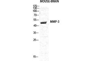 Western Blot analysis of various cells using MMP-3 Polyclonal Antibody diluted at 1:2000.