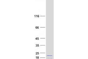 Western Blotting (WB) image for Centromere Protein A (CENPA) (Transcript Variant 2) protein (Myc-DYKDDDDK Tag) (ABIN2713904)
