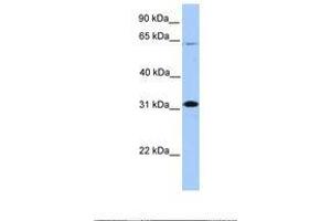 Image no. 1 for anti-Cbp/p300-Interacting Transactivator, with Glu/Asp-Rich Carboxy-terminal Domain, 2 (CITED2) (N-Term) antibody (ABIN6737849)