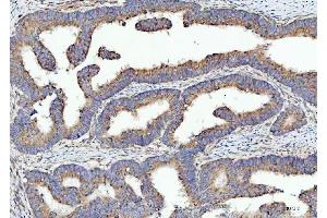 IHC analysis of SPATA18 using anti-SPATA18 antibody (ABIN7601020).