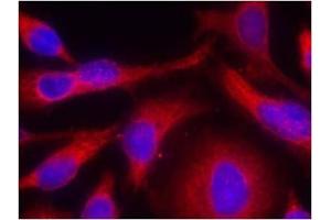 Image no. 1 for anti-Protein Kinase D1 (PRKD1) (pSer738) antibody (ABIN196754) (PKC mu 抗体  (pSer738))