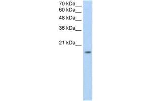 Western Blotting (WB) image for anti-Zinc Finger Protein 580 (ZNF580) antibody (ABIN2461874) (ZNF580 抗体)