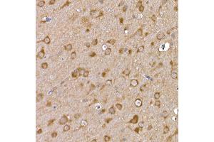 Immunohistochemistry (IHC) image for anti-GDNF Family Receptor alpha 1 (GFRA1) (AA 25-280) antibody (ABIN6141065)