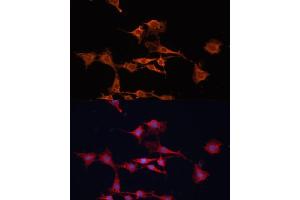 Immunofluorescence analysis of C6 cells using GSTM3 antibody (ABIN6131967, ABIN6141470, ABIN6141471 and ABIN6223605) at dilution of 1:100. (GSTM3 抗体  (AA 101-225))