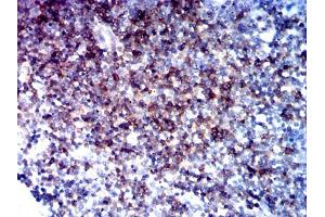 Immunohistochemical analysis of paraffin-embedded tonsil tissues using CD5 mouse mAb with DAB staining. (CD5 抗体  (AA 403-495))