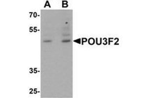 Western blot analysis of POU3F2 in 3T3 cell lysate with POU3F2 antibody at (A) 1 and (B) 2 μg/mL.