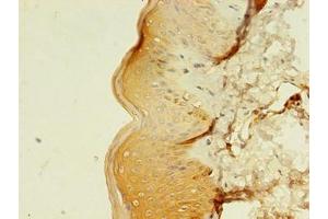 Immunohistochemistry of paraffin-embedded human skin tissue using ABIN7159241 at dilution of 1:100 (MLANA 抗体  (AA 1-118))