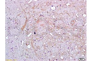 Formalin-fixed and paraffin embedded rat brain tissue labeled with Anti-IL-18 Polyclonal Antibody (ABIN669696), Unconjugated at 1:200, followed by conjugation to the secondary antibody and DAB staining (IL-18 抗体)