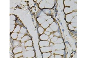 Immunohistochemistry of paraffin-embedded Human colon using AZGP1 Polyclonal Antibody at dilution of 1:100 (40x lens). (AZGP1 抗体)