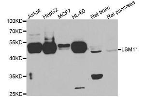 LSM11 抗体  (AA 131-360)