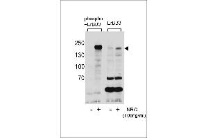 Western blot analysis of extracts from T47D cells,untreated or treated with NRG using Phospho-ErBB3(Tyr1289)(left) or ErBB3 Antibody (right). (ERBB3 抗体  (pTyr1289))