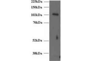 Image no. 1 for anti-Unc-13 Homolog D (UNC13D) (C-Term) antibody (ABIN374437) (UNC13D 抗体  (C-Term))