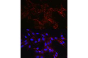 Immunofluorescence (IF) image for anti-Hexokinase 1 (HK1) (AA 20-300) antibody (ABIN3021309)