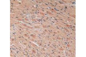 IHC-P analysis of Mouse Heart Tissue, with DAB staining. (VEGFC 抗体  (AA 108-223))
