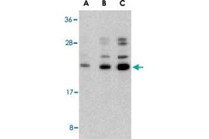 Western blot analysis of CASP6 in Jurkat cell lysate with CASP6 polyclonal antibody  at (A) 0. (Caspase 6 抗体  (N-Term))