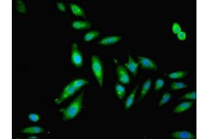 Immunofluorescent analysis of Hela cells using ABIN7153665 at dilution of 1:100 and Alexa Fluor 488-congugated AffiniPure Goat Anti-Rabbit IgG(H+L) (Non-Syndromic Hearing Impairment Protein 5 (GSDME) (AA 1-496) 抗体)