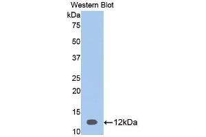 Western Blotting (WB) image for anti-serpin Peptidase Inhibitor, Clade A (Alpha-1 Antiproteinase, Antitrypsin), Member 12 (SERPINA12) (AA 52-143) antibody (ABIN3208031) (SERPINA12 抗体  (AA 52-143))