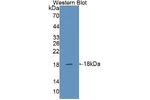 Detection of Recombinant SNAPAP, Human using Polyclonal Antibody to SNAP Associated Protein (SNAPAP)