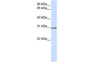 AKT1S1 antibody used at 1 ug/ml to detect target protein. (PRAS40 抗体)