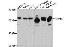 Western blot analysis of extracts of various cell lines, using PPP5C Antibody (ABIN4904845) at 1:3000 dilution. (PP5 抗体)