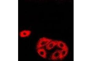 Immunofluorescent analysis of HAPLN1 staining in Hela cells. (HAPLN1 抗体)
