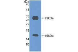 Detection of Recombinant SIRT3, Mouse using Polyclonal Antibody to Sirtuin 3 (SIRT3) (SIRT3 抗体  (AA 5-257))