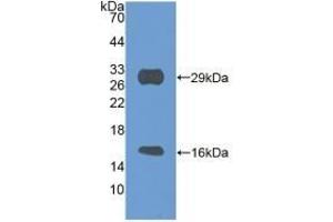Detection of Recombinant SIRT3, Mouse using Polyclonal Antibody to Sirtuin 3 (SIRT3)
