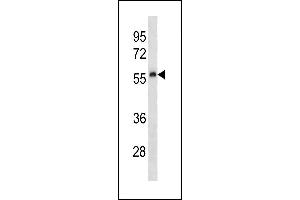 Mouse Plau Antibody (C-term) (ABIN1881658 and ABIN2843214) western blot analysis in human placenta tissue lysates (35 μg/lane). (PLAU 抗体  (C-Term))