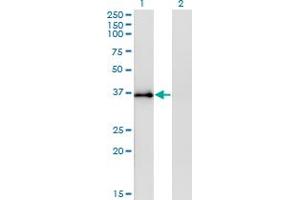 Western Blot analysis of STX12 expression in transfected 293T cell line by STX12 monoclonal antibody (M01), clone 3B9. (Syntaxin 12 抗体  (AA 108-206))