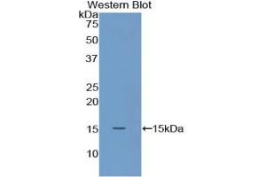 Western blot analysis of the recombinant protein. (S100A9 抗体  (AA 1-113))