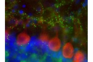 Immunofluorescence staining of adult rat cerebellum with N29/29 (green), N326D/2 (red) and Hoechst nuclear stain (blue).
