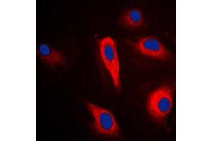 Immunofluorescent analysis of Cytokeratin 16 staining in HeLa cells. (KRT16 抗体  (C-Term))