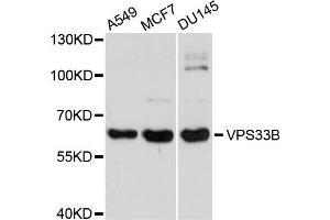 Western blot analysis of extracts of various cells, using VPS33B antibody. (VPS33B 抗体)