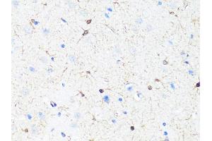 Immunohistochemistry of paraffin-embedded rat brain using TH Antibody (ABIN5974878) at dilution of 1/100 (40x lens). (TH 抗体)