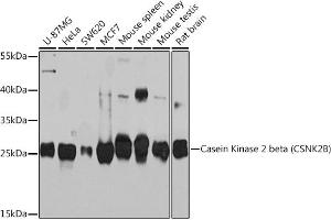 Western blot analysis of extracts of various cell lines, using Casein Kinase 2 beta (Casein Kinase 2 beta (CSNK2B)) Rabbit pAb (ABIN7266104) at 1:1000 dilution. (CSNK2B 抗体  (AA 1-215))
