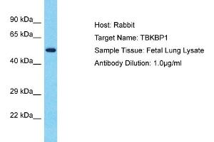 Host: Rabbit Target Name: TBKBP1 Sample Type: Fetal Lung lysates Antibody Dilution: 1. (TBKBP1 抗体  (N-Term))