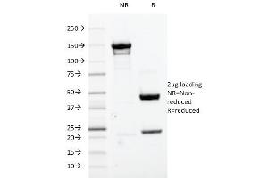 SDS-PAGE Analysis Purified Cdk1 Mouse Monoclonal Antibody (A17. (CDK1 抗体  (C-Term))