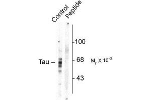 Image no. 1 for anti-Microtubule-Associated Protein tau (MAPT) (pSer416) antibody (ABIN372727) (MAPT 抗体  (pSer416))