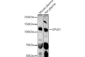 Western blot analysis of extracts of various cell lines, using GPLD1 antibody (ABIN6131716, ABIN6141335, ABIN6141336 and ABIN6222300) at 1:1000 dilution. (GPLD1 抗体  (AA 24-160))