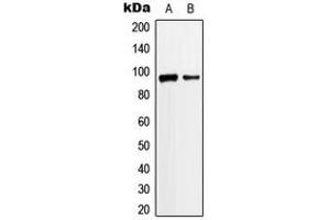 Western blot analysis of ANKRD20A3 expression in Jurkat (A), K562 (B) whole cell lysates. (ANKRD20A3 抗体  (Center))