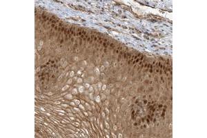 Immunohistochemical staining of human esophagus with NAF1 polyclonal antibody  shows strong nuclear and cytoplasmic positivity in squamous epithelial cells at 1:50-1:200 dilution. (NAF1 抗体)