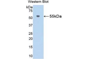 Western Blotting (WB) image for anti-Angiotensinogen (serpin Peptidase Inhibitor, Clade A, Member 8) (AGT) (AA 25-477) antibody (ABIN7432631)