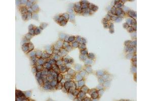 ICC testing of HCT116 cell (CD44 抗体  (C-Term))