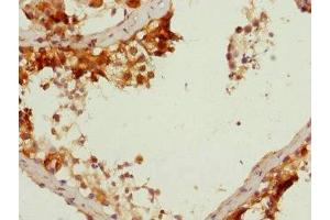 Immunohistochemistry of paraffin-embedded human testis tissue using ABIN7149639 at dilution of 1:100 (DAZ2 抗体  (AA 1-200))