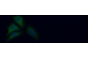 Detection of PKLR in Human HepG2 cell using Polyclonal Antibody to Pyruvate kinase isozymes R/L (PKLR) (PKLR 抗体  (AA 219-420))
